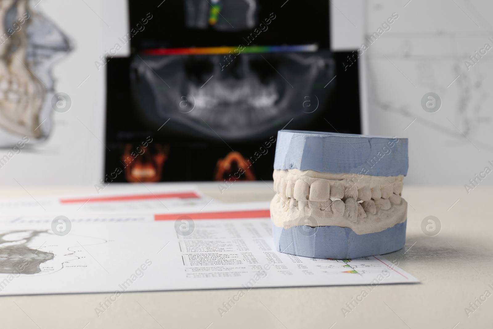 Photo of Dental model with gums, anatomy charts and panoramic x-ray on table. Cast of teeth