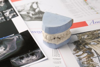Photo of Dental model with gums, anatomy charts and panoramic x-ray. Cast of teeth