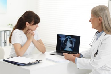 Photo of Lung cancer. Doctor showing chest x-ray on laptop to her patient in clinic