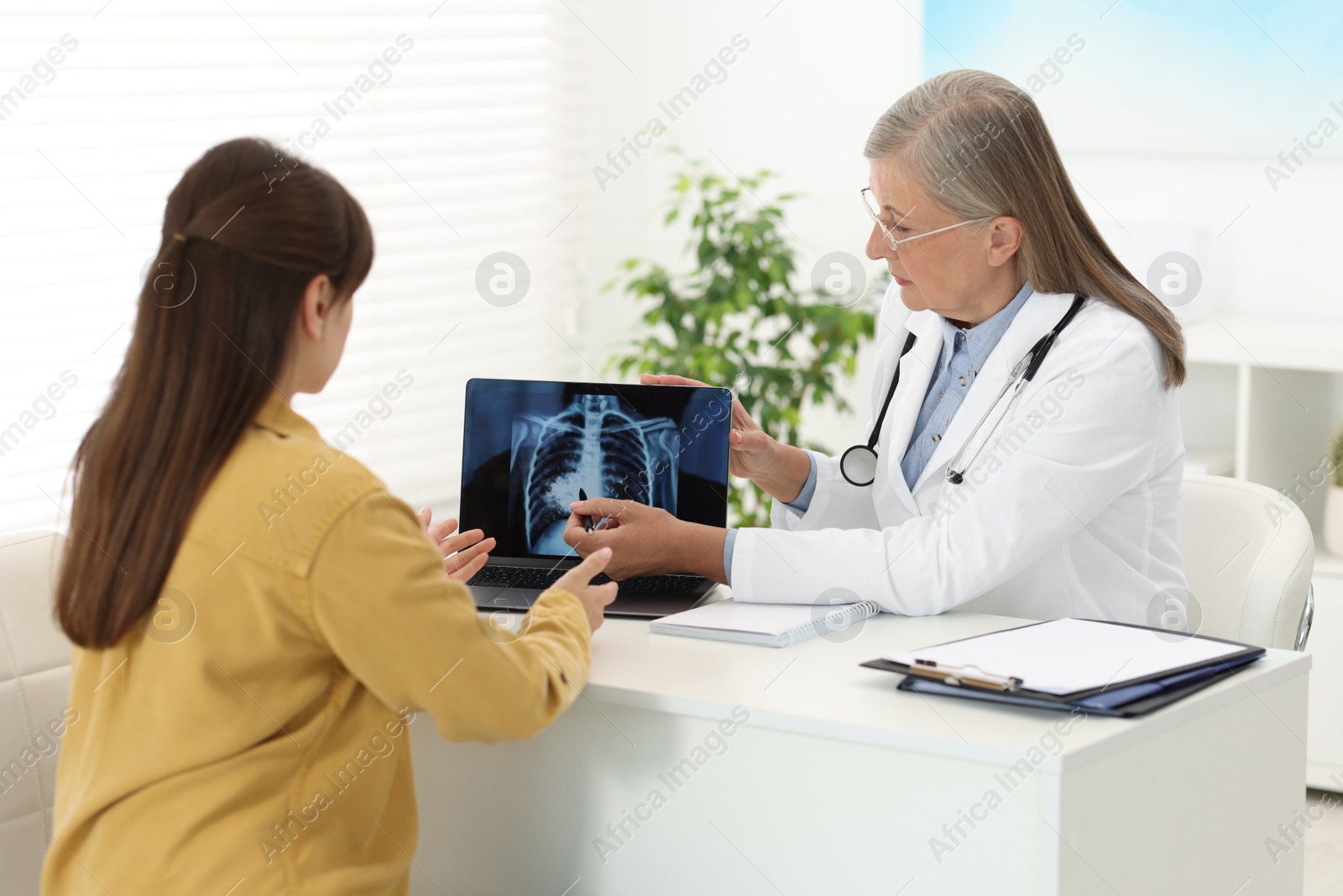 Photo of Lung cancer. Doctor showing chest x-ray on laptop to her patient in clinic