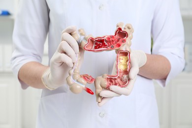 Photo of Doctor with model of large intestine in clinic, closeup