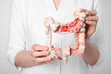 Photo of Doctor with model of large intestine on light grey background, closeup