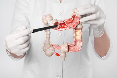 Doctor showing model of large intestine on light grey background, closeup