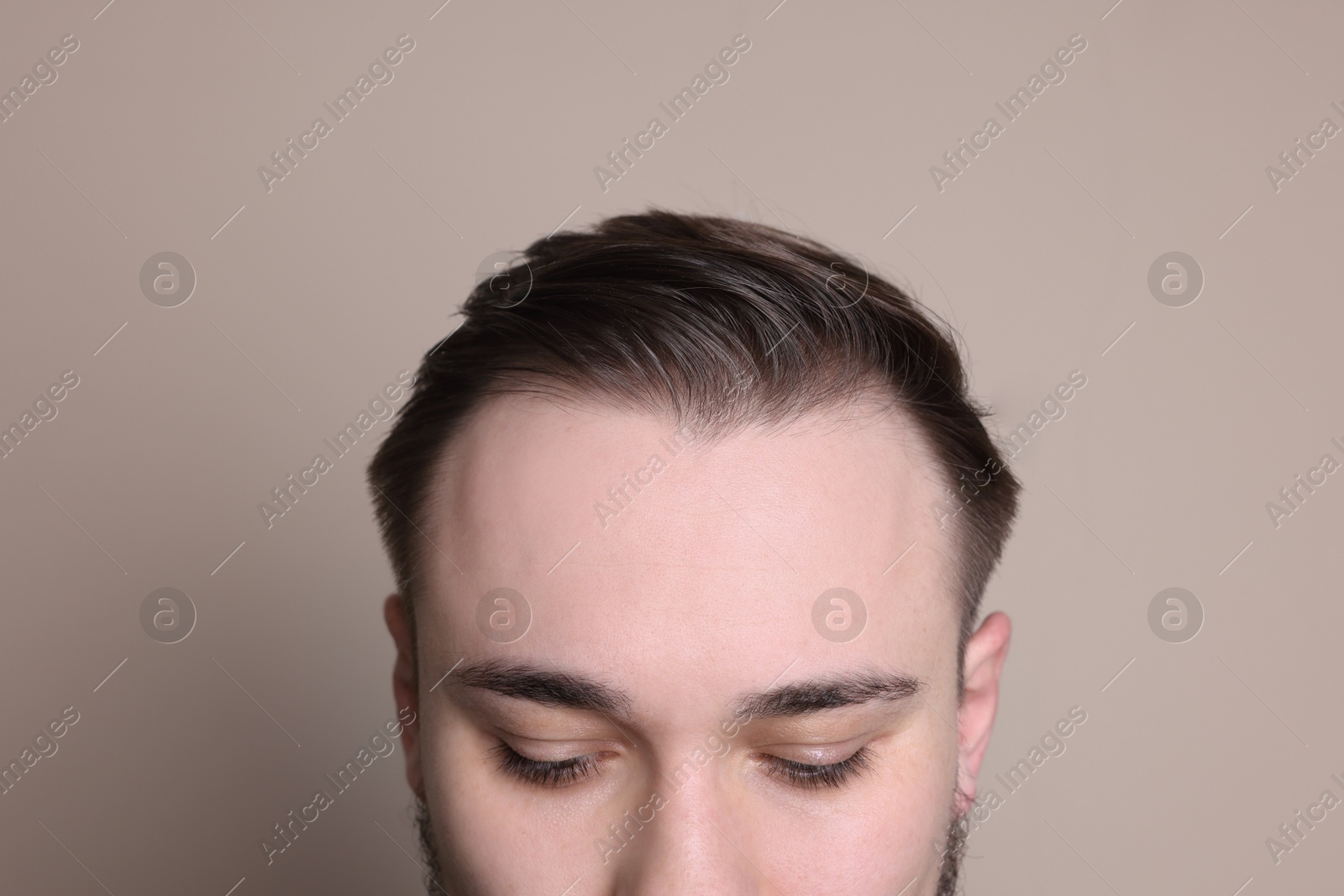 Photo of Baldness concept. Man with receding hairline on beige background, closeup