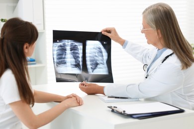 Photo of Lung disease. Doctor showing chest x-ray to her patient in clinic