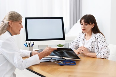 Lung disease. Doctor showing chest x-ray to her patient in clinic