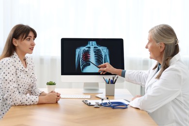 Lung cancer. Doctor showing chest x-ray to her patient in clinic