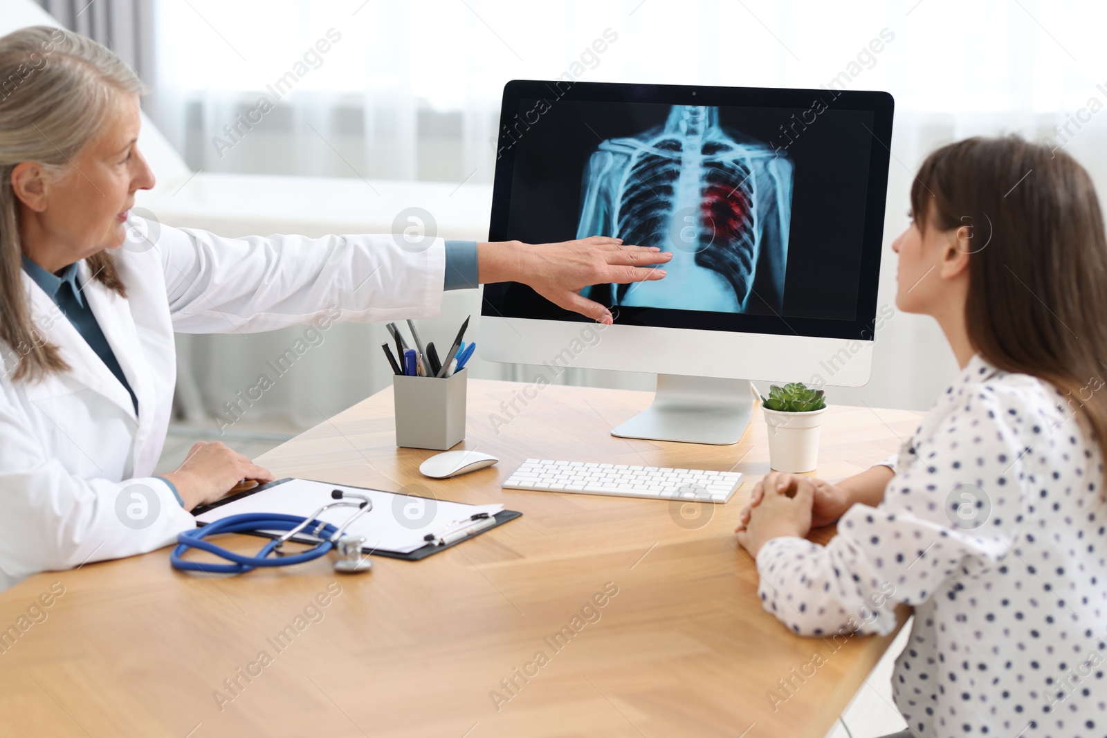 Photo of Lung cancer. Doctor showing chest x-ray to her patient in clinic