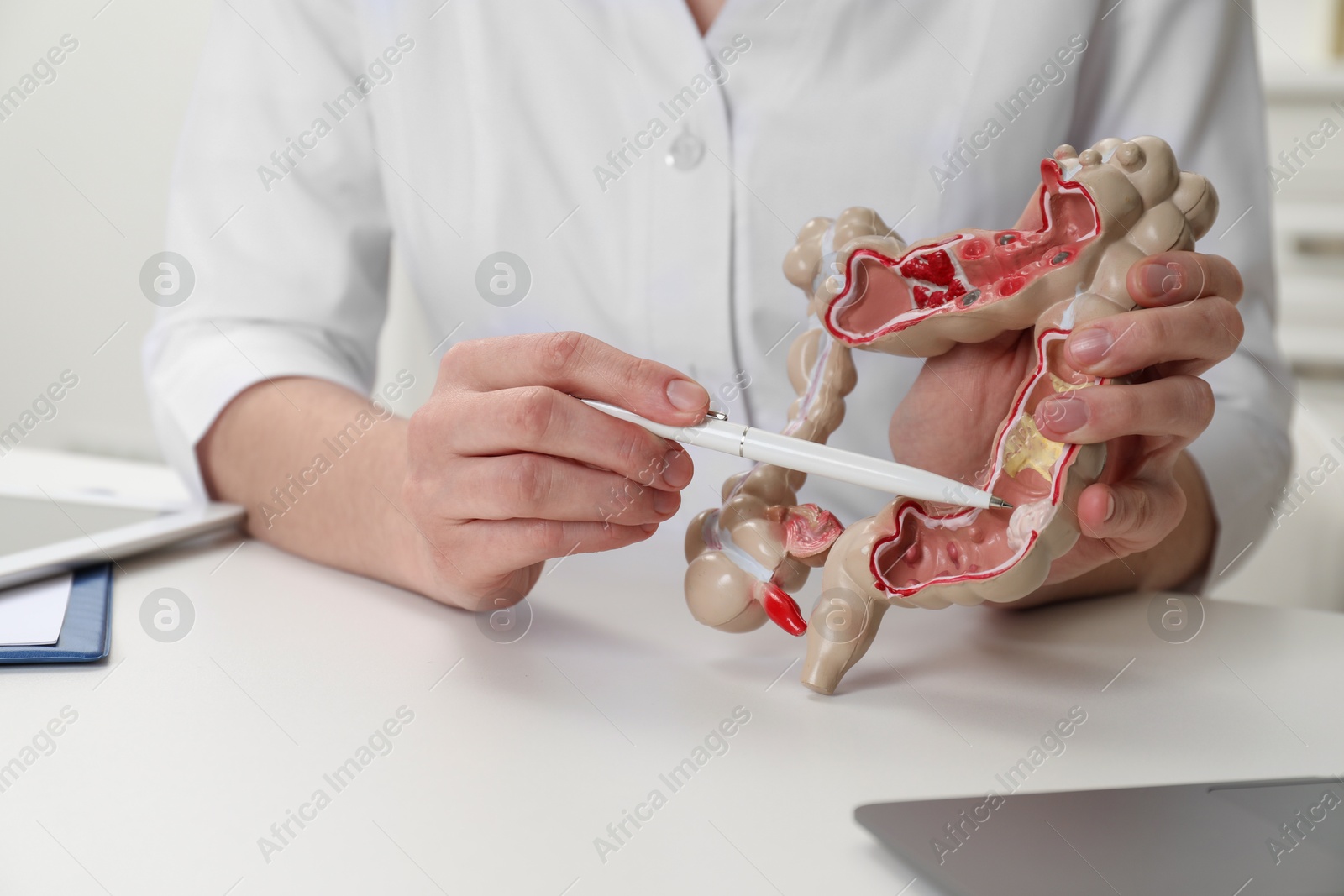 Photo of Doctor showing model of large intestine at white table in clinic, closeup