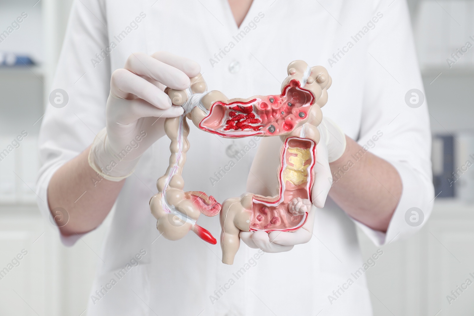 Photo of Doctor with model of large intestine in clinic, closeup