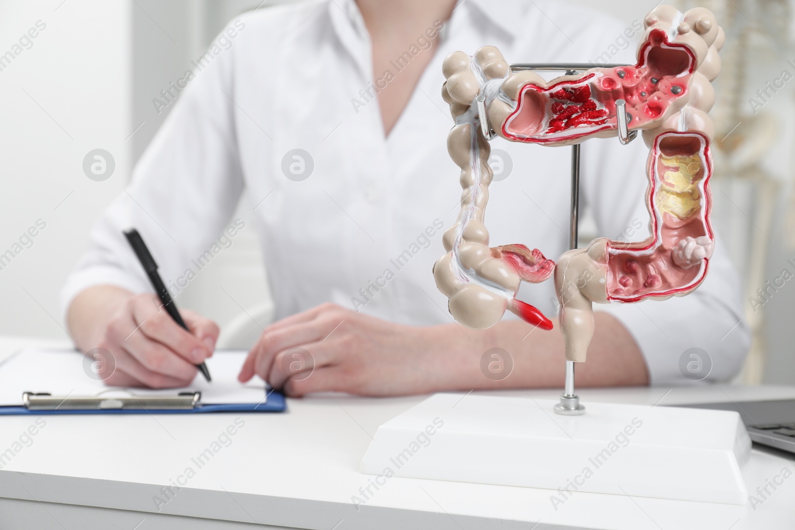 Photo of Doctor working at white table, focus on model of large intestine