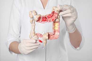 Doctor with model of large intestine on light grey background, closeup
