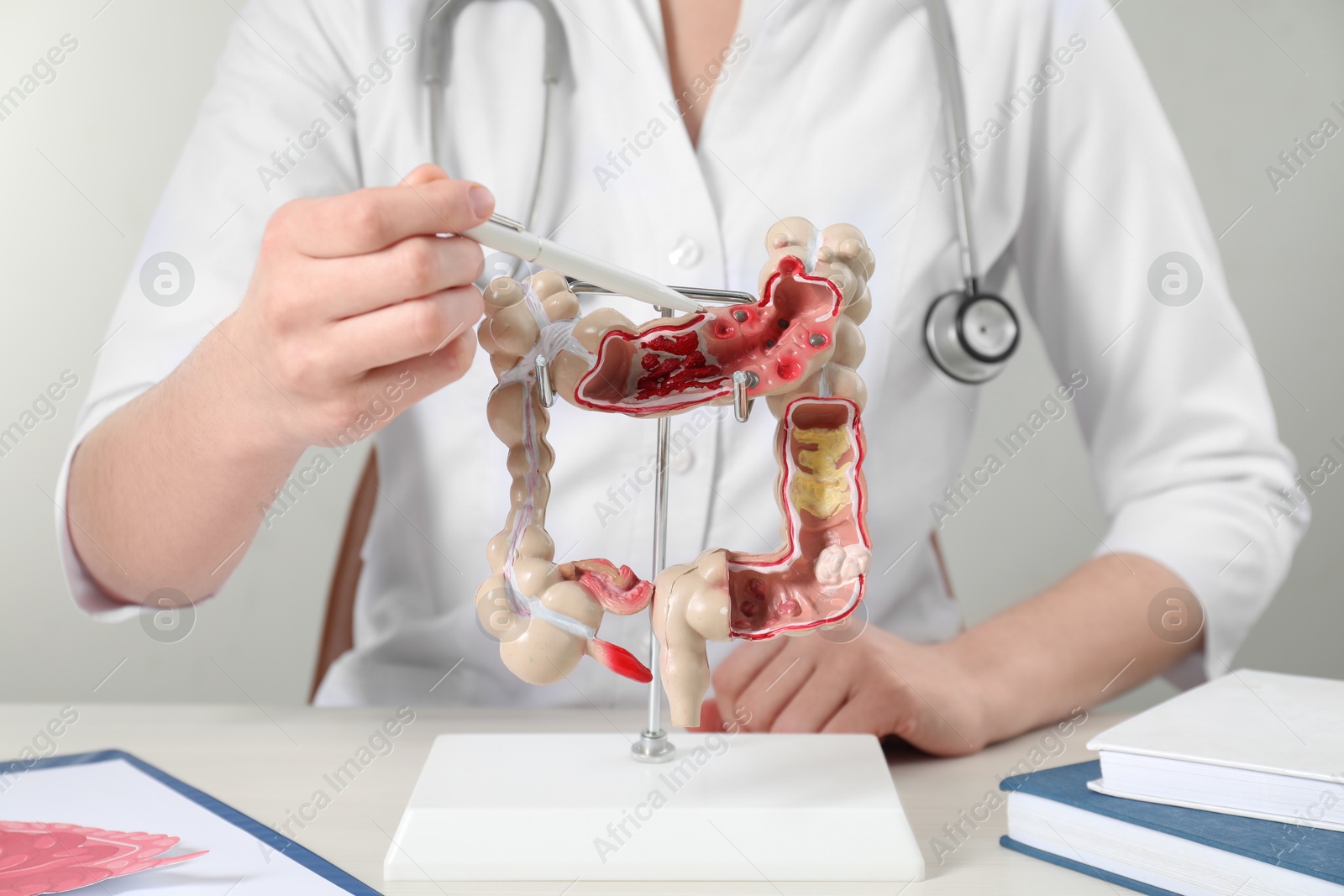 Photo of Doctor showing model of large intestine at table, closeup