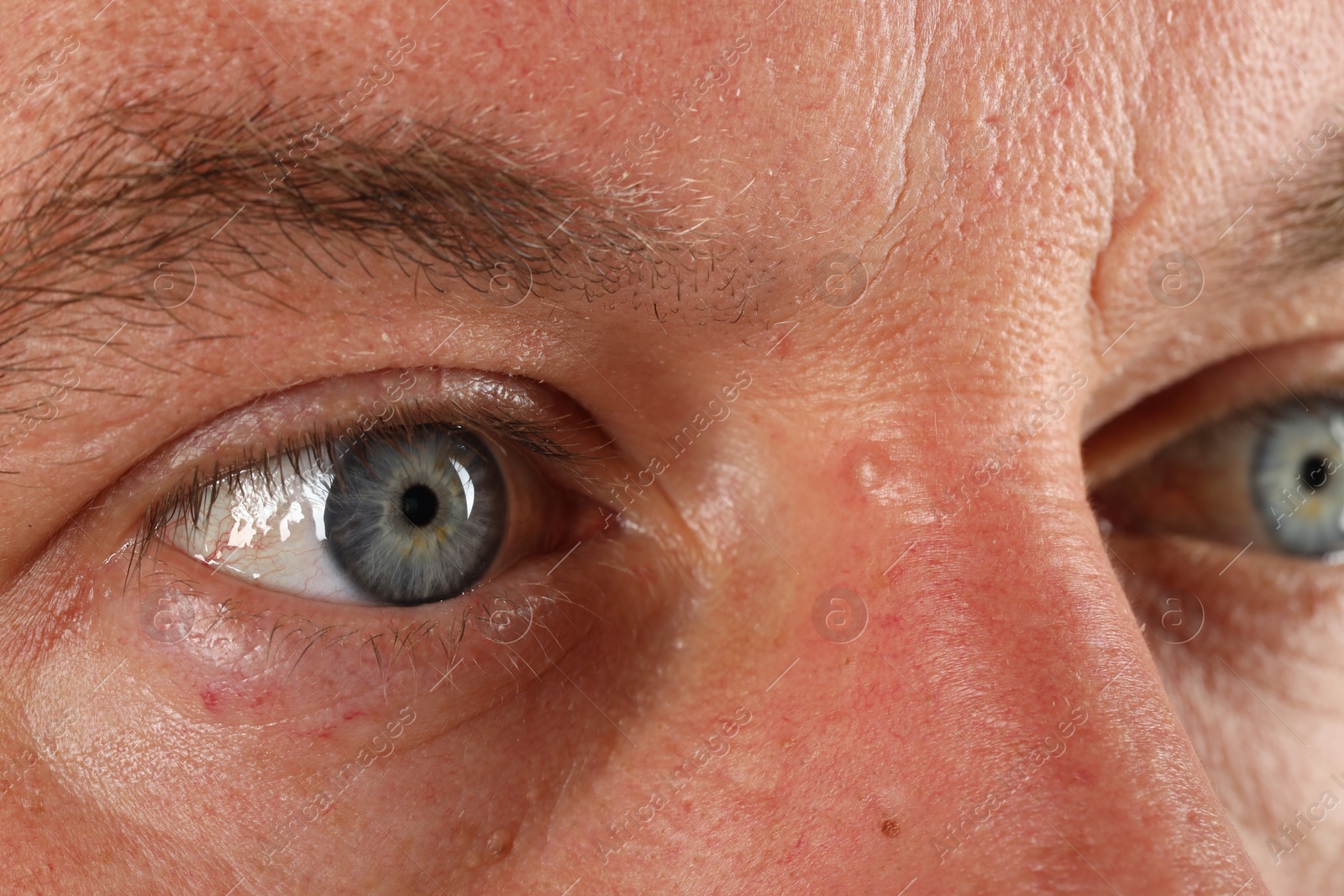 Photo of Man with beautiful blue eyes, closeup view