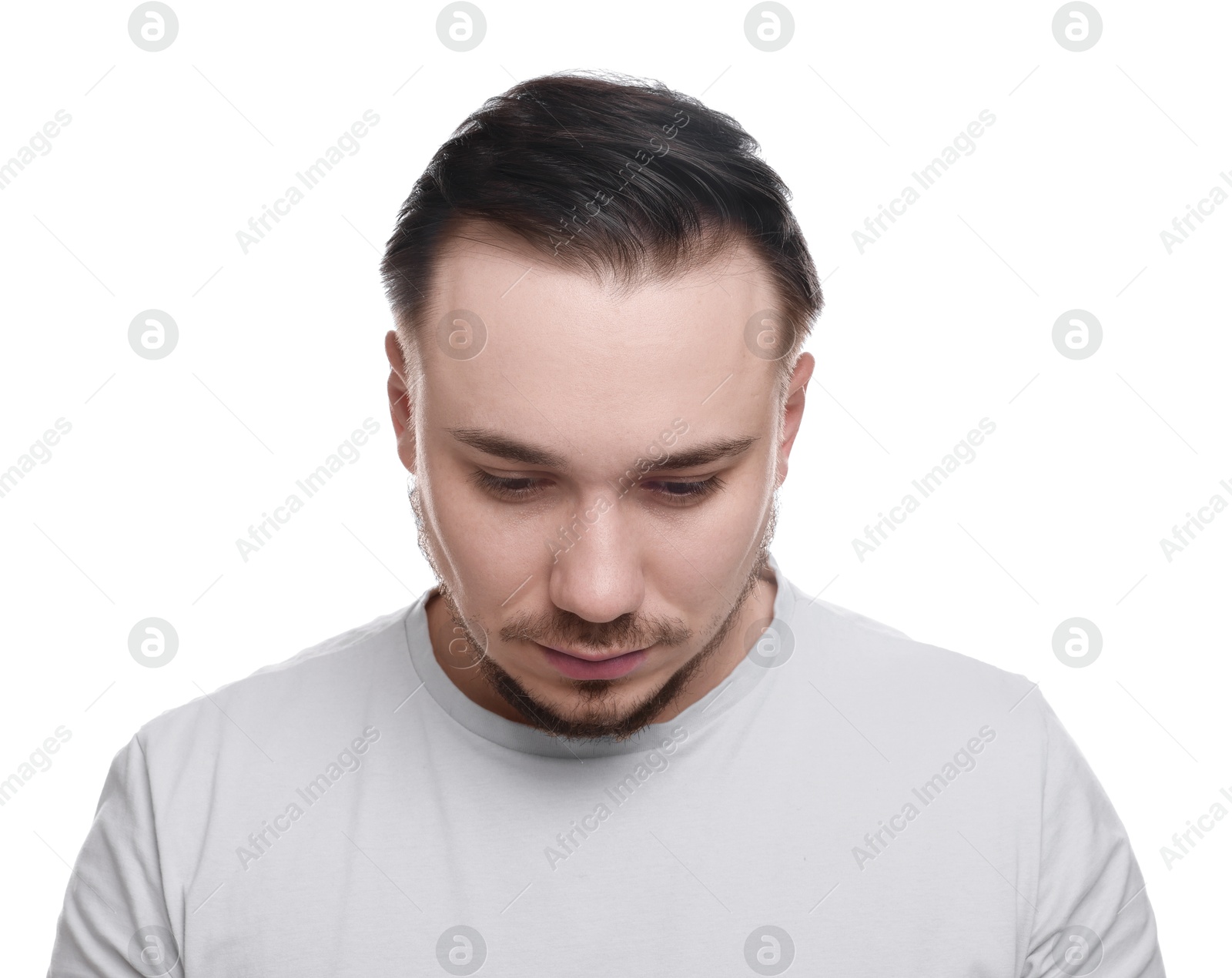 Photo of Baldness concept. Sad man with receding hairline on white background
