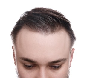 Photo of Baldness concept. Man with receding hairline on white background, closeup