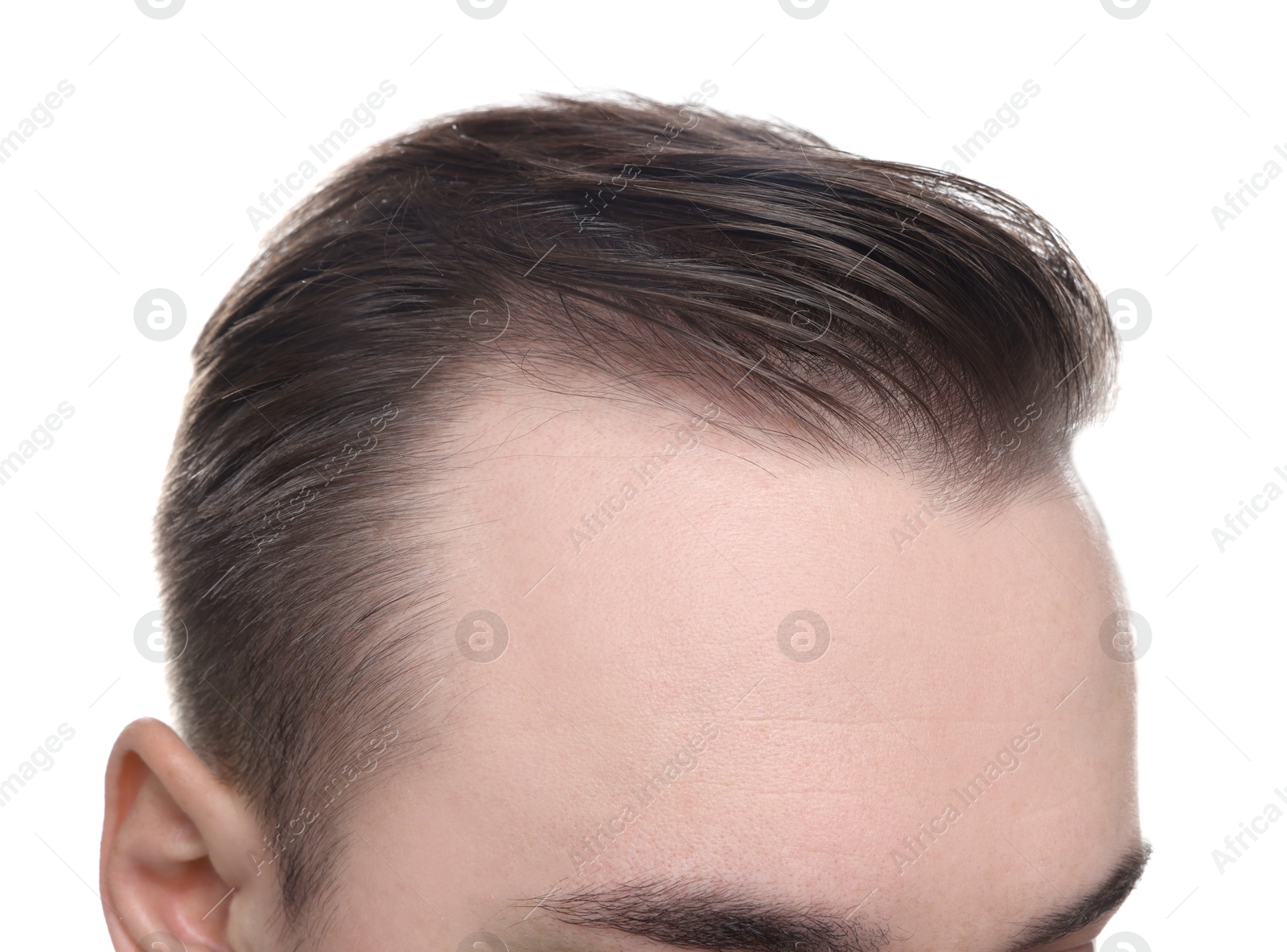 Photo of Baldness concept. Man with receding hairline on white background, closeup