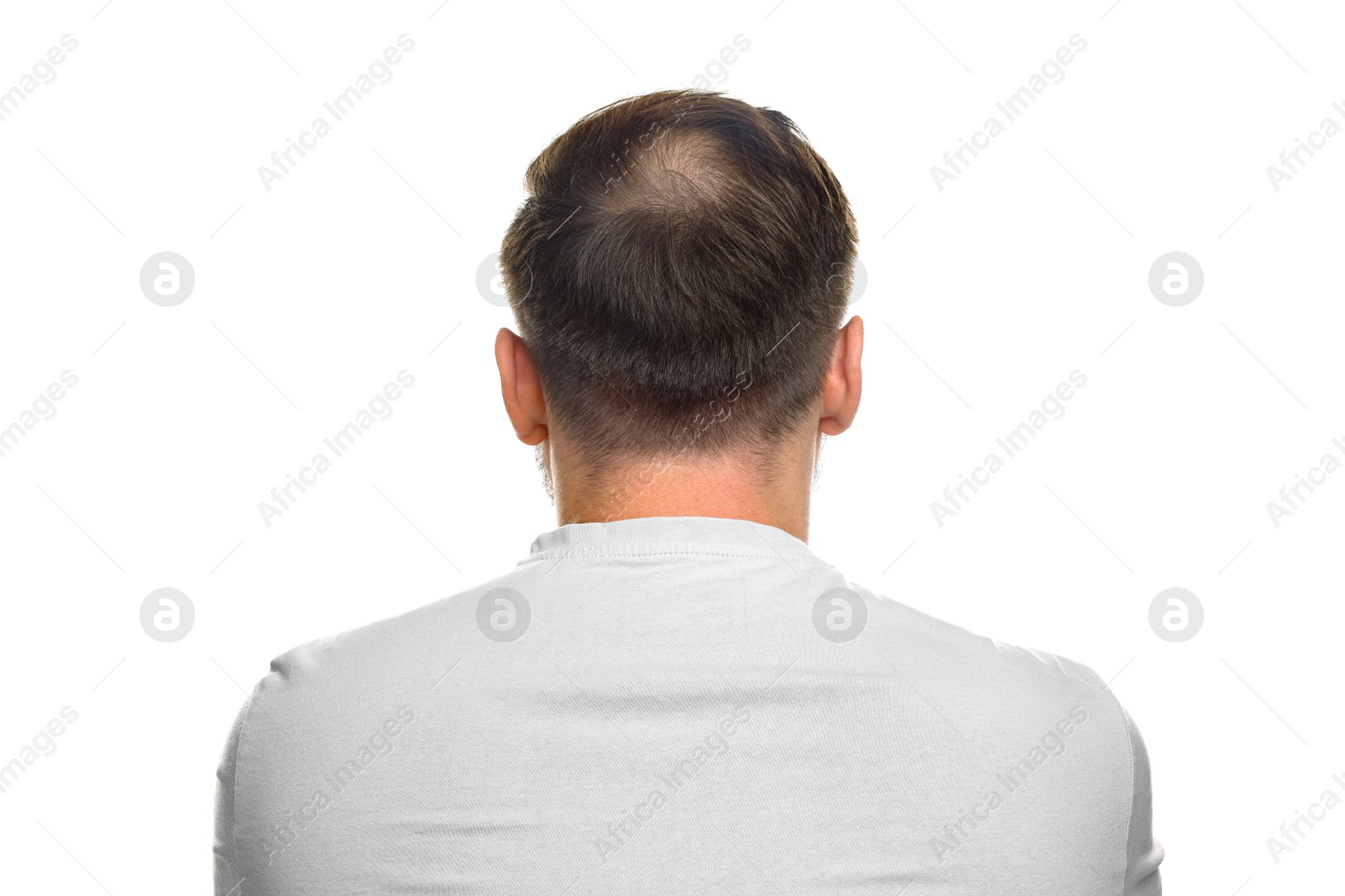 Photo of Baldness concept. Man with bald spot on white background, back view