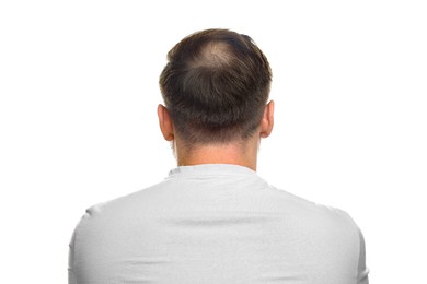 Photo of Baldness concept. Man with bald spot on white background, back view