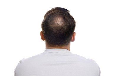 Baldness concept. Man with bald spot on white background, back view