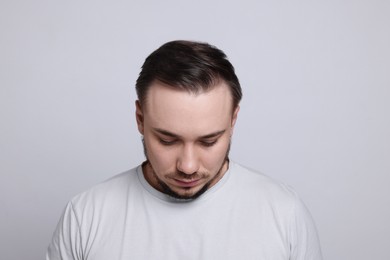 Photo of Baldness concept. Sad man with receding hairline on light grey background