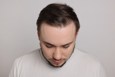 Photo of Baldness concept. Sad man with receding hairline on light grey background