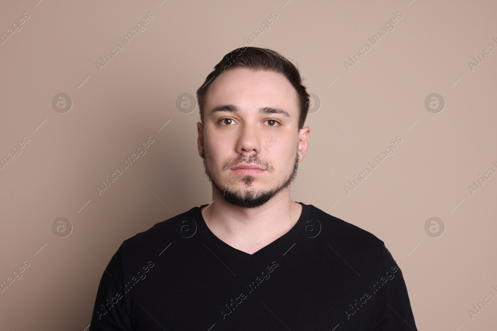 Photo of Baldness concept. Sad man with receding hairline on beige background