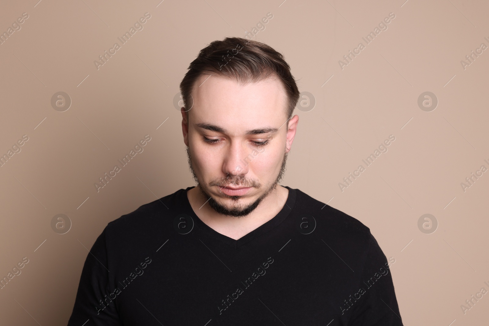 Photo of Baldness concept. Sad man with receding hairline on beige background