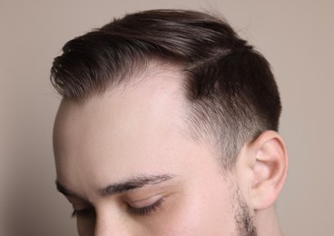 Baldness concept. Man with receding hairline on beige background, closeup