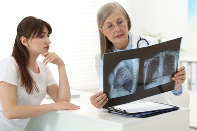 Lung disease. Doctor showing chest x-ray to her patient in clinic