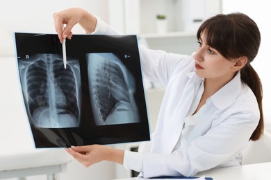 Photo of Lung disease. Doctor showing chest x-ray in clinic