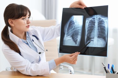 Lung disease. Doctor examining chest x-ray at table in clinic