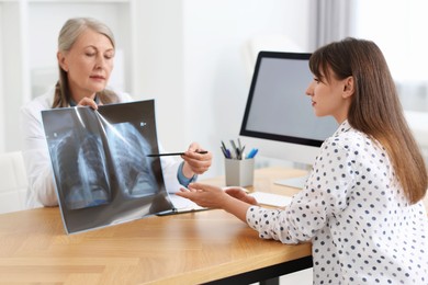 Lung disease. Doctor showing chest x-ray to her patient in clinic