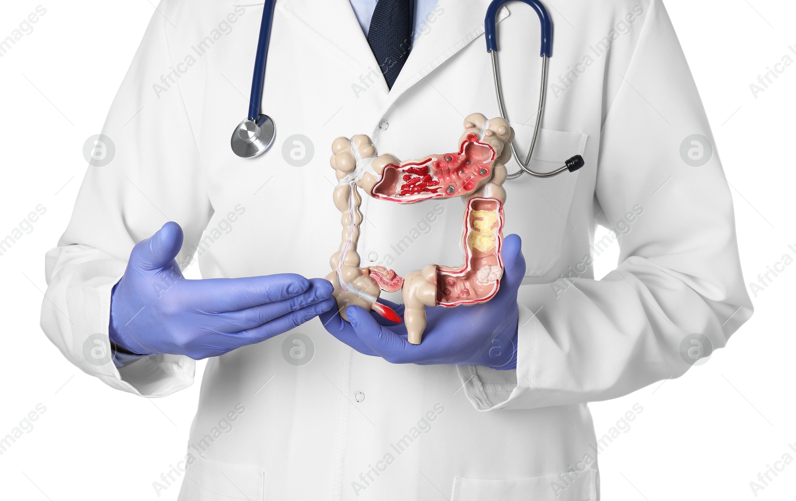Photo of Doctor with model of large intestine on white background, closeup