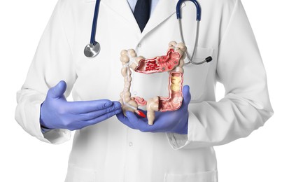 Doctor with model of large intestine on white background, closeup