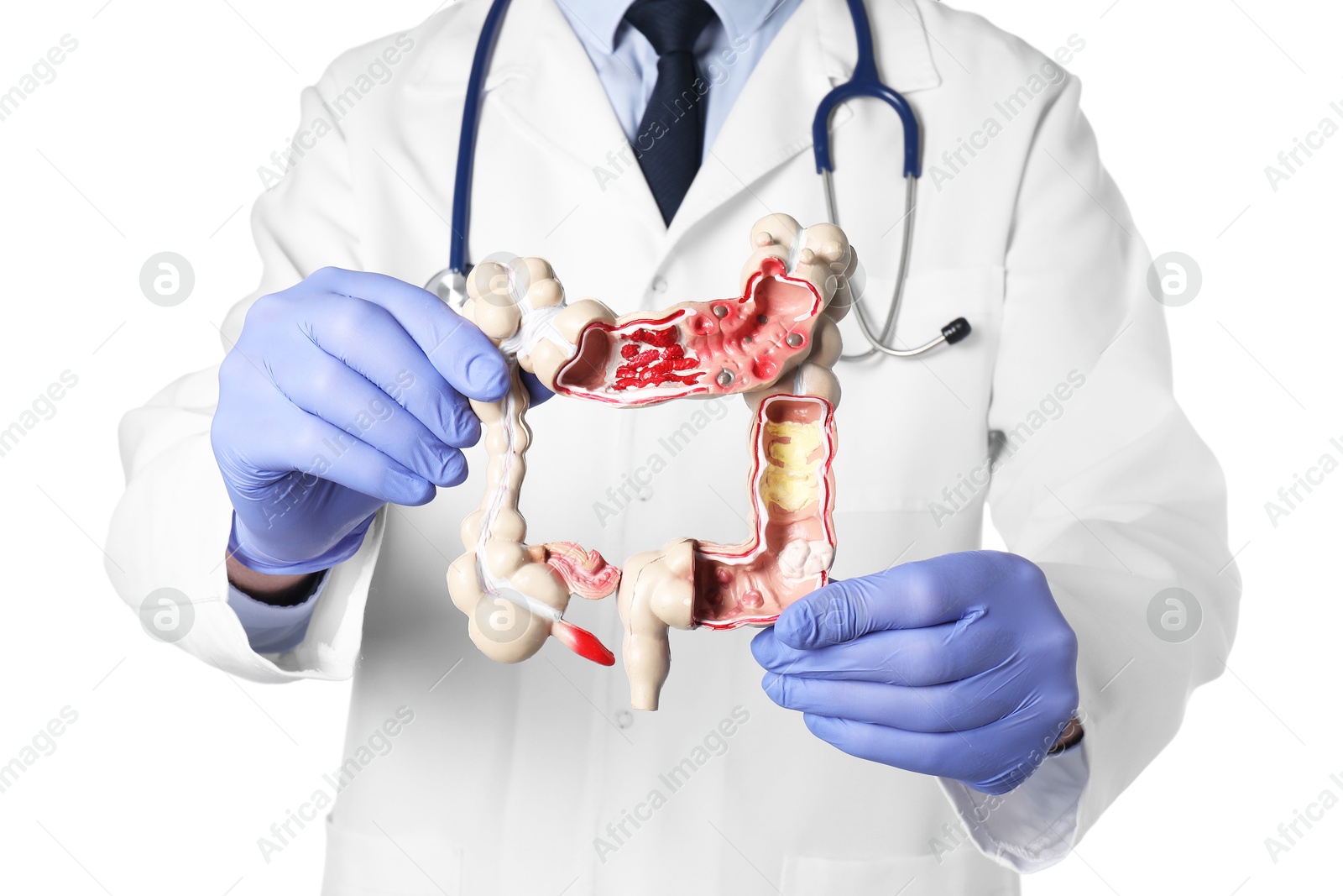 Photo of Doctor with model of large intestine on white background, closeup