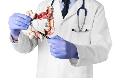 Doctor showing model of large intestine on white background, closeup