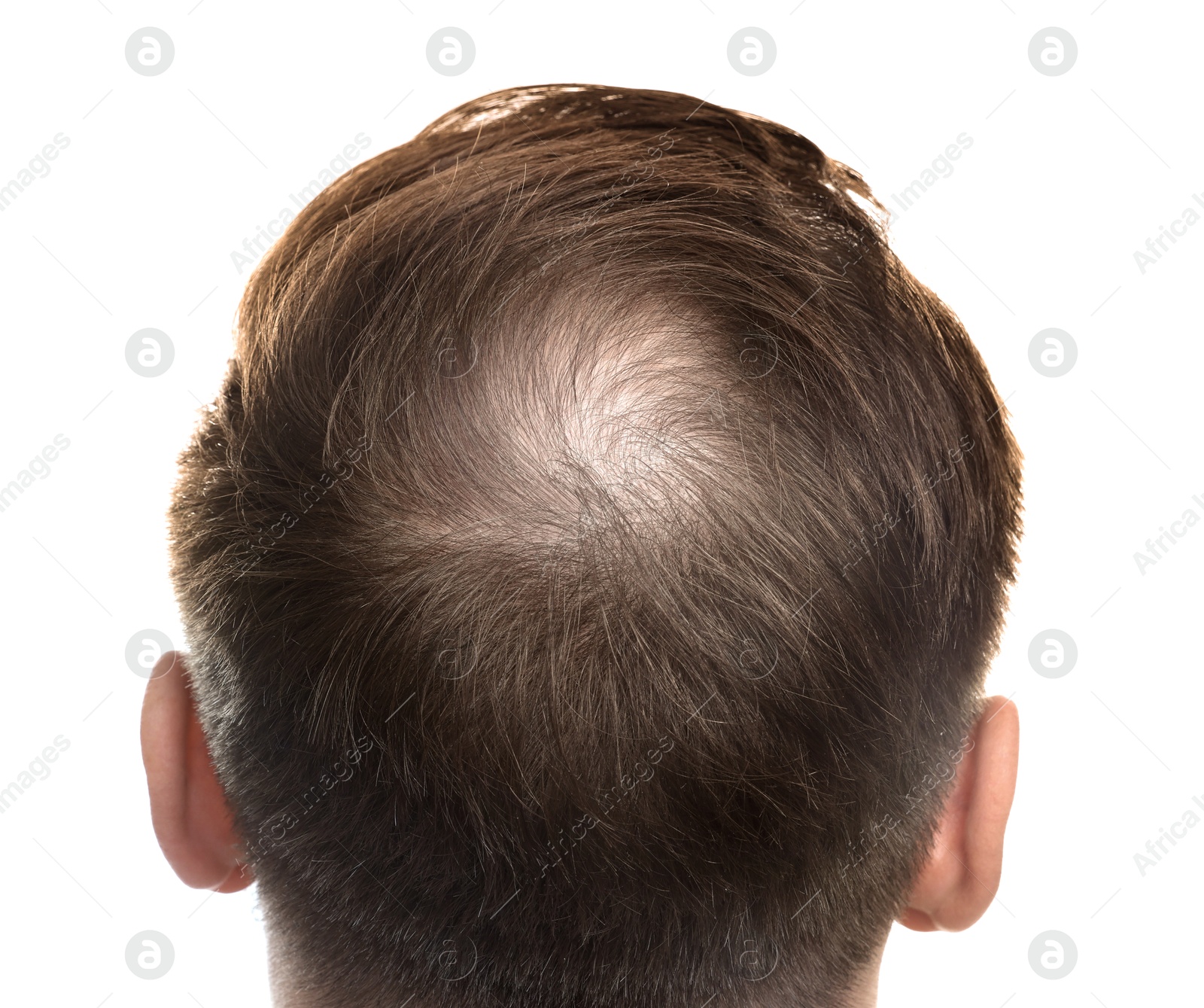 Photo of Baldness concept. Man with bald spot on white background, back view