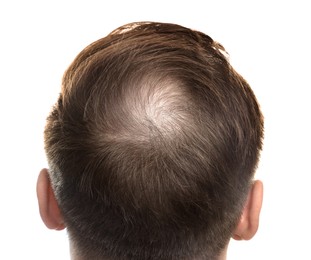 Photo of Baldness concept. Man with bald spot on white background, back view