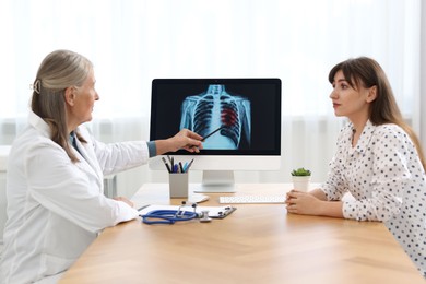 Photo of Lung cancer. Doctor showing chest x-ray to her patient in clinic