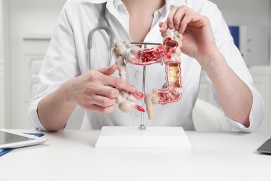 Photo of Doctor showing model of large intestine at white table in clinic, closeup