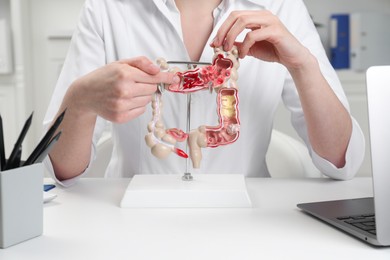 Doctor showing model of large intestine at white table in clinic, closeup