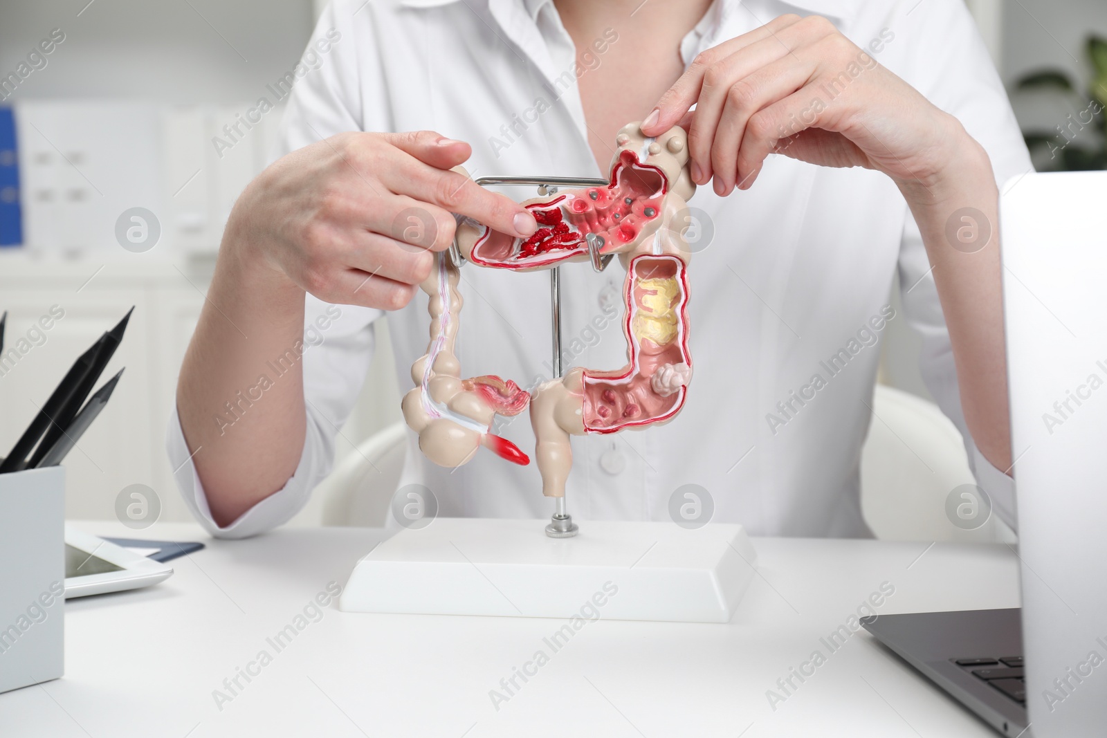 Photo of Doctor showing model of large intestine at white table in clinic, closeup