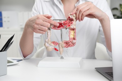 Photo of Doctor showing model of large intestine at white table in clinic, closeup