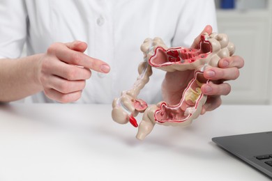 Photo of Doctor showing model of large intestine at white table in clinic, closeup