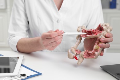 Photo of Doctor showing model of large intestine at white table in clinic, closeup