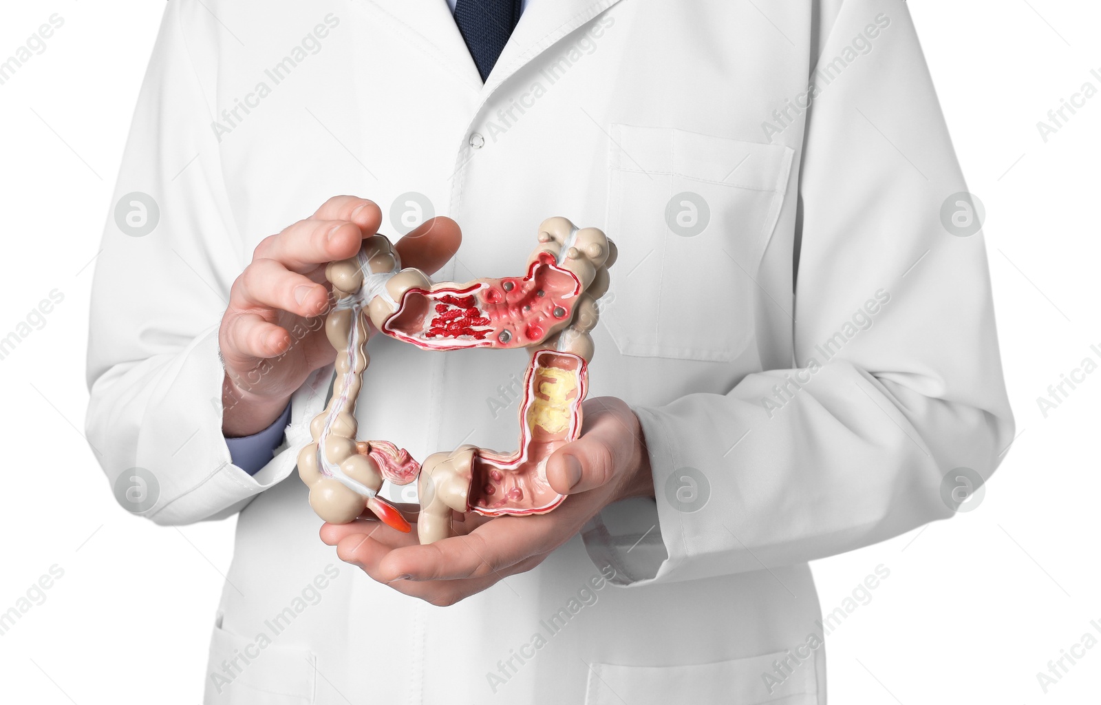 Photo of Doctor with model of large intestine on white background, closeup
