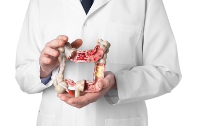 Doctor with model of large intestine on white background, closeup