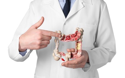 Doctor showing model of large intestine on white background, closeup