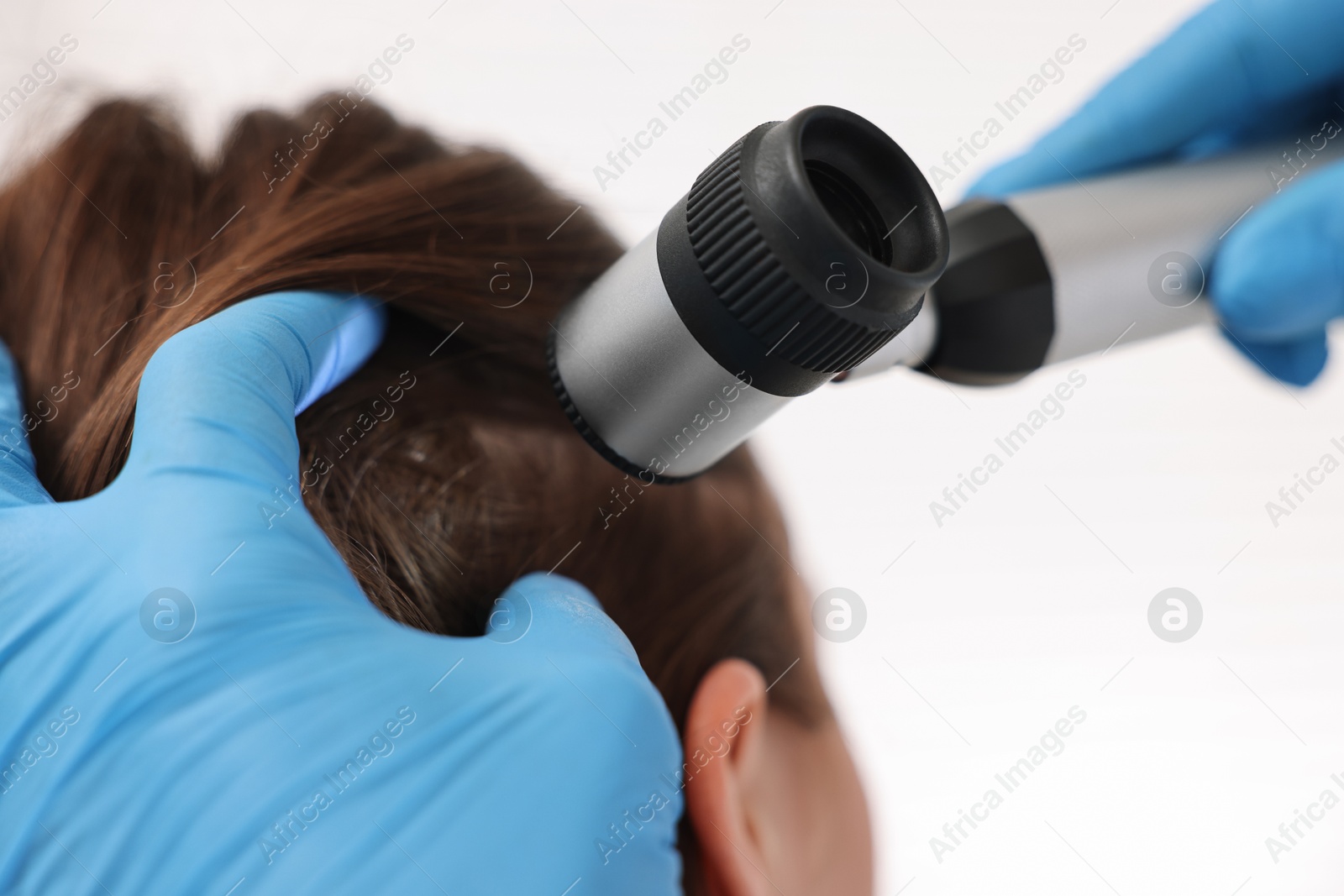 Photo of Trichologist with dermatoscope examining patient`s hair in clinic, closeup